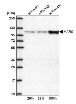 Methionyl tRNA synthetase Antibody, Novus Biologicals 25 &mu;L; Unlabeled:Antibodies,